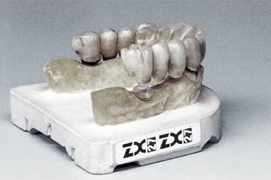 ZX-27 Attractive Glass Abutment System