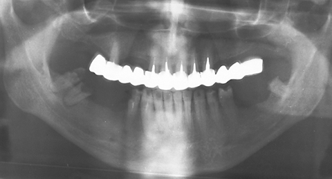 RO graph - ZX-27 sample 1 after-treatment