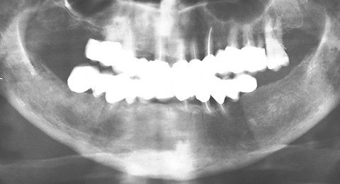 RO graph - ZX-27 sample 2 after-treatment