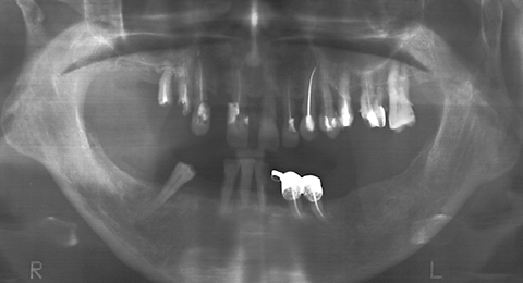 RO graph - ZX-27 sample 2 pre-treatment