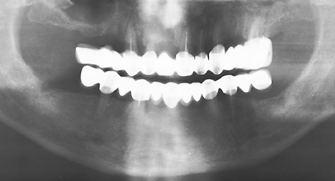 RO graph - ZX-27 sample 3 after-treatment