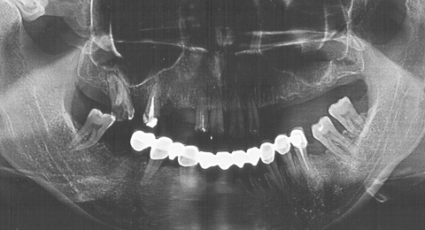 RO graph - ZX-27 sample 4 pre-treatment